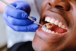 man with teeth being examined by dentist, teeth cleaning atascocita tx