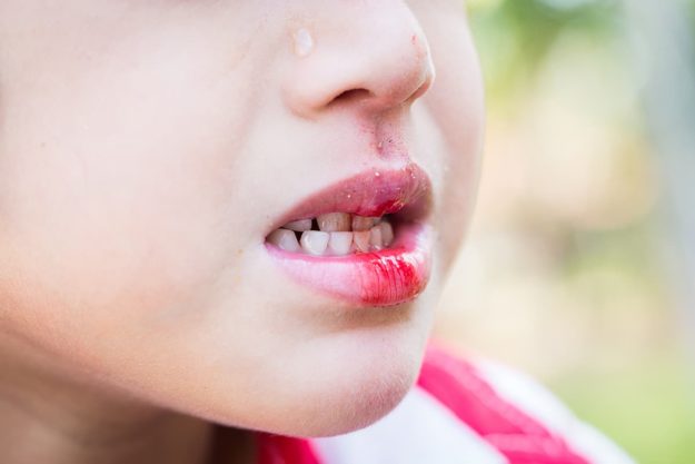 What to Do When Your Child Faces a Pediatric Dental Emergency child faces a dental emergency