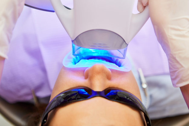 teeth whitening options (1) patient getting teeth whitening options