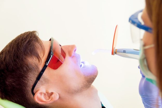 dental sealants