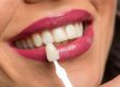 woman being fitted for dental veneers